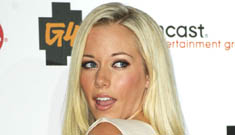 Kendra Wilkinson: “I will 100% have liposuction”