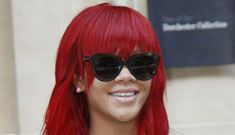 More photos of a beaten and bruised Rihanna for sale