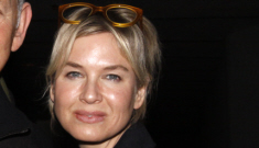 “Is Renee Zellweger still messing with her face?” links
