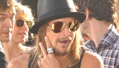 Kid Rock equates his marriage to Pam Anderson with touching a hot stove