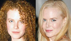 Celebrity plastic surgery before and after