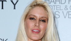 Heidi Montag celebrates her 25th birthday in Vegas, her   face looks awful