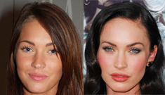 Has Megan Fox really spent $60,000 on plastic surgery?