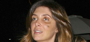 Brittny Gastineau’s attacker claims she started it, but he doesn’t have hard feelings