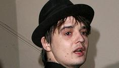 “Pete Doherty is too afraid of needles to get a tattoo” morning links