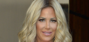 Kim Zolciak blatantly lied to Andy Cohen about her nose job, duck lips