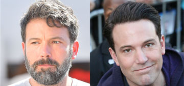 Did Ben Affleck get too much Botox or is something else going on?