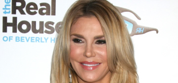 Brandi Glanville got 6 stitches & a hairline fracture after Hoverboard accident