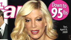 Star cover: Tori Spelling needs help for an eating disorder