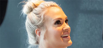 Carrie Underwood shared a new photo of her face clearly showing her scars