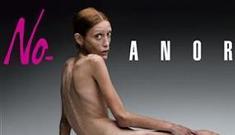 Anorexic woman used to promote Italian fashion brand