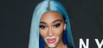 Winnie Harlow criticized for half complaining about sleeping in coach