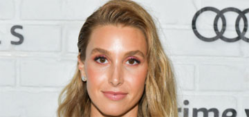 Whitney Port’s migraines feel like ‘someone is smashing my temples with a hammer’