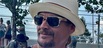 Kid Rock’s band members have covid, he claims some are vaccinated
