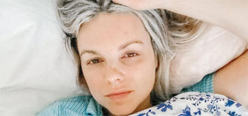 Ali Fedotowsky-Manno, 37, got shingles: ‘I can’t even explain how horrible the pain was’