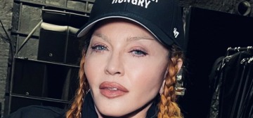 Madonna: ‘Look how cute i am now that swelling from surgery has gone down. Lol’
