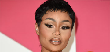 Blac Chyna had her fillers removed, says her face looked like a box