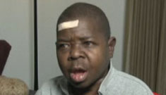 Gary Coleman on his New Year’s seizure and “ugly” full frontal body double