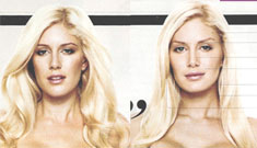 Heidi Montag: Before and after latest round of plastic surgery