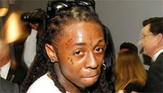 Lil Wayne’s yearlong jail sentence delayed so he can have dental surgery