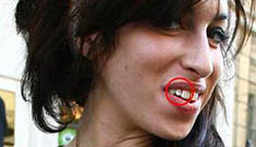 Amy Winehouse gets teeth fixed, some advice from Keith Richards