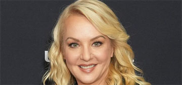 Wendi McLendon-Covey didn’t go to the Oscars because she had a neck lift