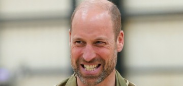 What is ‘baldmaxxing’ and is it an option for Prince William & Prince Harry?
